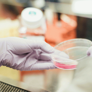 Entwicklung einer Kultivierungsmethode für Prostataorganoide Entwicklung einer Kultivierungsmethode für Prostataorganoide