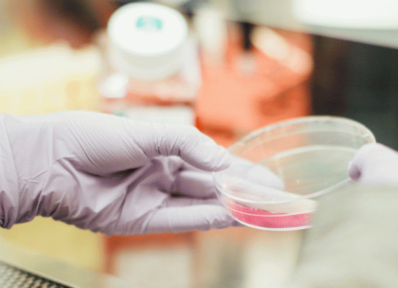 Entwicklung einer Kultivierungsmethode für Prostataorganoide