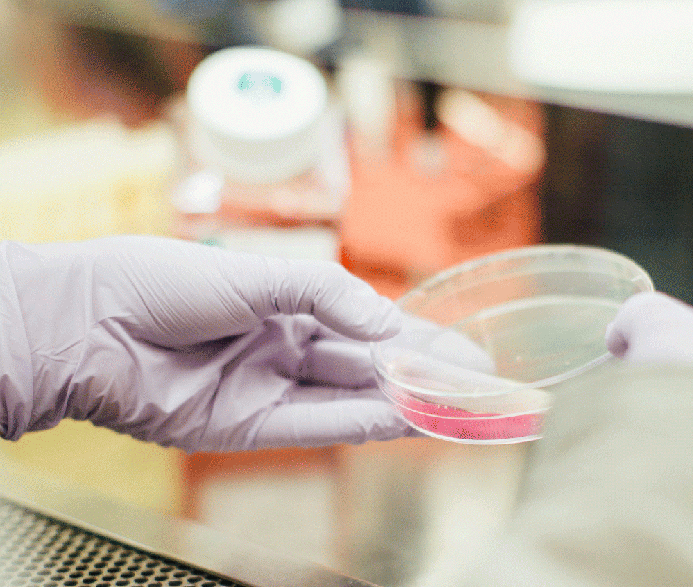 Entwicklung einer Kultivierungsmethode für Prostataorganoide Entwicklung einer Kultivierungsmethode für Prostataorganoide